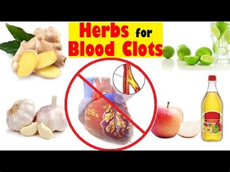 clotsiti|How to Get Rid of Blood Clots: Treatment and More .